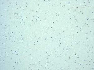 Immunohistochemistry (Formalin/PFA-fixed paraffin-embedded sections) - Anti-SLP76 antibody [EPR2549(2)] (AB109254)