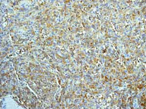 Immunohistochemistry (Formalin/PFA-fixed paraffin-embedded sections) - Anti-SLP76 antibody [EPR2549(2)] - BSA and Azide free (AB247808)