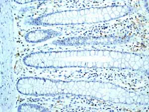Immunohistochemistry (Formalin/PFA-fixed paraffin-embedded sections) - Anti-SLP76 antibody [EPR2549(2)] - BSA and Azide free (AB247808)