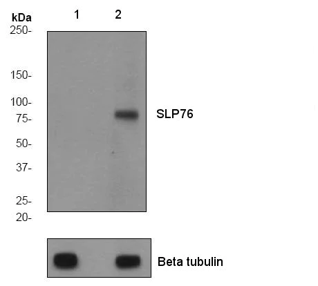 Western blot - Anti-SLP76 (phospho Y113) antibody [EPR2851] (AB75990)