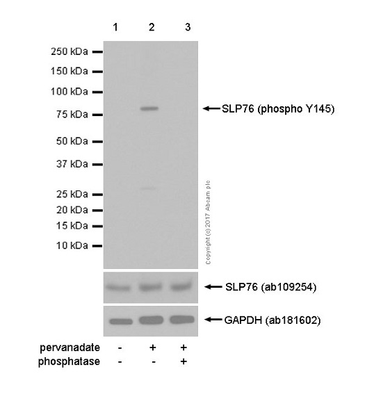 Western blot - Anti-SLP76 (phospho Y145) antibody [EP2853Y] (AB75829)