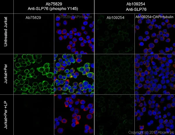 Immunocytochemistry/ Immunofluorescence - Anti-SLP76 (phospho Y145) antibody [EP2853Y] - BSA and Azide free (AB206782)