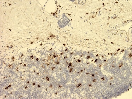 Immunohistochemistry (Frozen sections) - Anti-SLPI antibody [31] (AB17157), expandable thumbnail