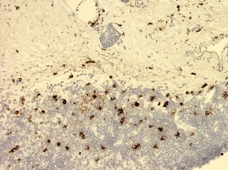 Immunohistochemistry (Frozen sections) - Anti-SLPI antibody [31] (AB17157)