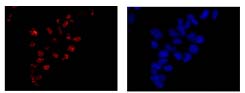 Immunocytochemistry/ Immunofluorescence - Anti-SLU7 antibody [EPR11111] (AB181138), expandable thumbnail