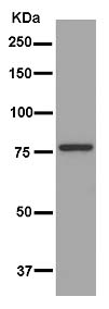 Western blot - Anti-SLU7 antibody [EPR11111] (AB181138), expandable thumbnail