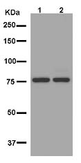 Western blot - Anti-SLU7 antibody [EPR11111] (AB181138), expandable thumbnail