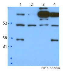 Western blot - Anti-SLUG antibody (AB106077)