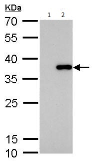 Western blot - Anti-SLUG antibody (AB183760), expandable thumbnail