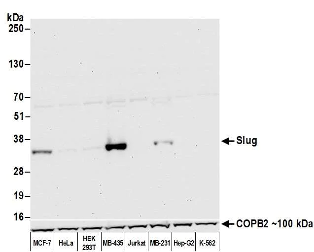 Western blot - Anti-Slug antibody [BLR139H] - BSA free (AB314086)