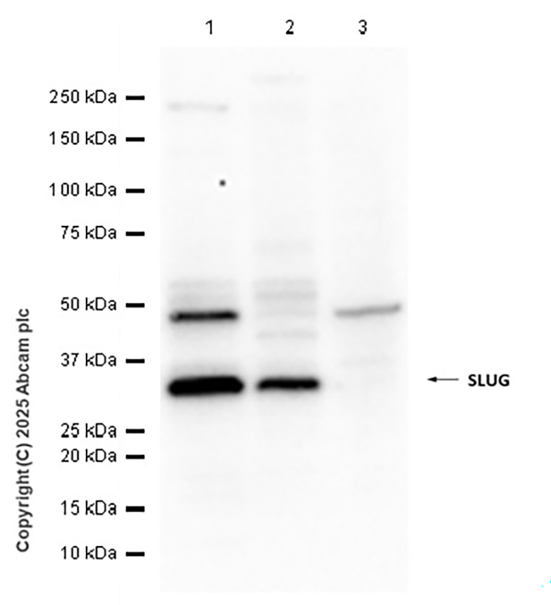 Western blot - Anti-SLUG antibody [EPR25113-46] (AB302780)