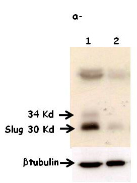 Western blot - Anti-SLUG antibody [mAbcam51772] (AB51772), expandable thumbnail