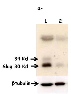 Western blot - Anti-SLUG antibody [mAbcam51772] (AB51772)