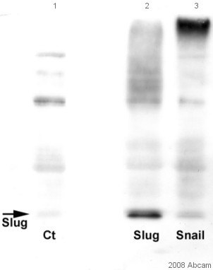 Western blot - Anti-SLUG antibody [mAbcam51772] (AB51772), expandable thumbnail