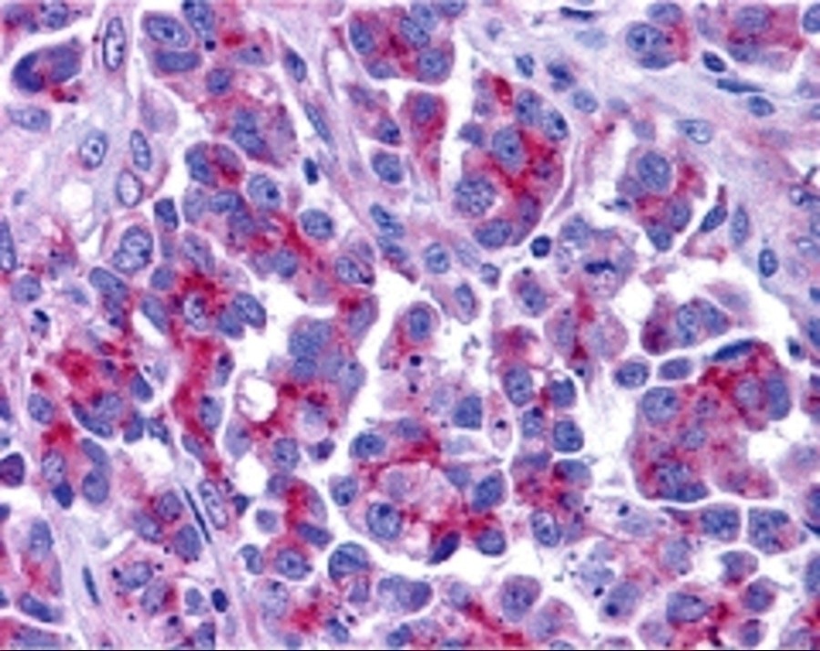 Immunohistochemistry (Formalin/PFA-fixed paraffin-embedded sections) - Anti-Smac/Diablo antibody (AB8114)