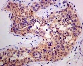 Immunohistochemistry (Formalin/PFA-fixed paraffin-embedded sections) - Anti-Smac/Diablo antibody [EPR10934] (AB174284)