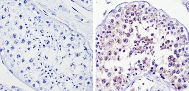 Immunohistochemistry (Formalin/PFA-fixed paraffin-embedded sections) - Anti-Smac/Diablo antibody [SMAC 17 1-87] (AB111893)
