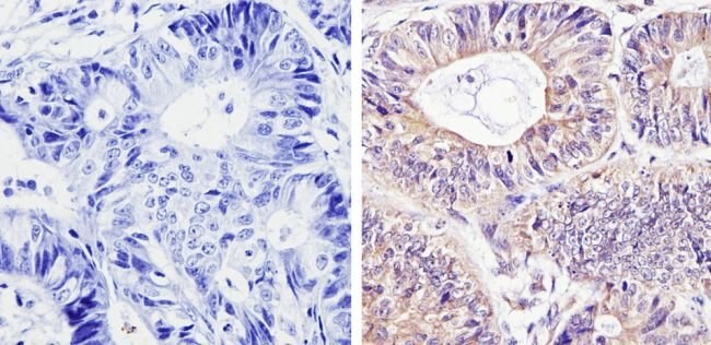 Immunohistochemistry (Formalin/PFA-fixed paraffin-embedded sections) - Anti-Smac/Diablo antibody [SMAC 17 1-87] (AB111893), expandable thumbnail