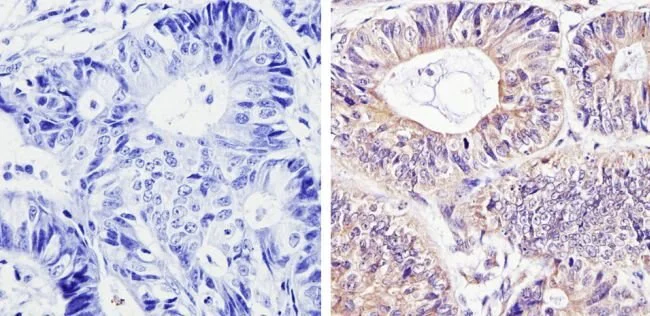 Immunohistochemistry (Formalin/PFA-fixed paraffin-embedded sections) - Anti-Smac/Diablo antibody [SMAC 17 1-87] (AB111893)