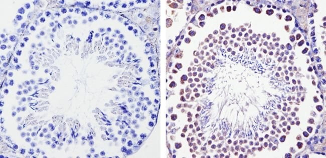 Immunohistochemistry (Formalin/PFA-fixed paraffin-embedded sections) - Anti-Smac/Diablo antibody [SMAC 17 1-87] (AB111893), expandable thumbnail