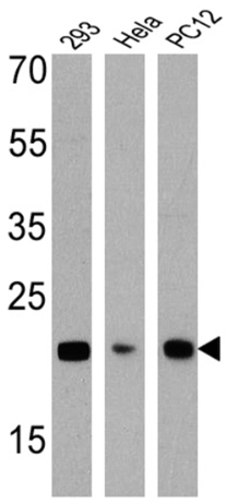 Western blot - Anti-Smac/Diablo antibody [SMAC 17 1-87] (ab111893), expandable thumbnail