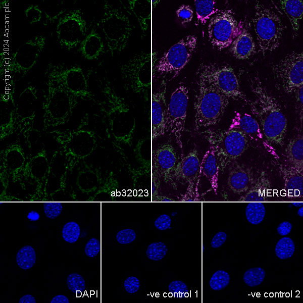 Immunocytochemistry/ Immunofluorescence - Anti-Smac/Diablo antibody [Y12] (ab32023), expandable thumbnail