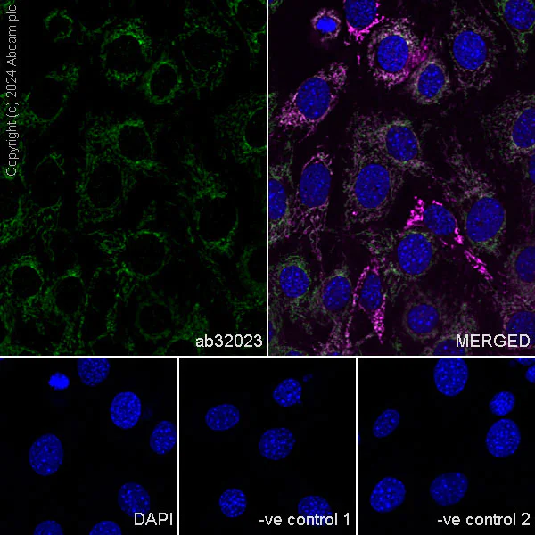 Immunocytochemistry/ Immunofluorescence - Anti-Smac/Diablo antibody [Y12] (AB32023)