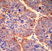 Immunohistochemistry (Formalin/PFA-fixed paraffin-embedded sections) - Anti-Smac/Diablo antibody [Y12] (AB32023), expandable thumbnail