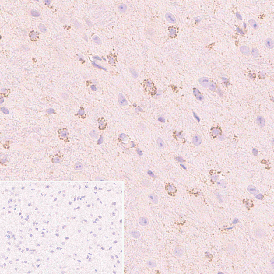 Immunohistochemistry (Formalin/PFA-fixed paraffin-embedded sections) - Anti-Smac/Diablo antibody [Y12] (ab32023), expandable thumbnail