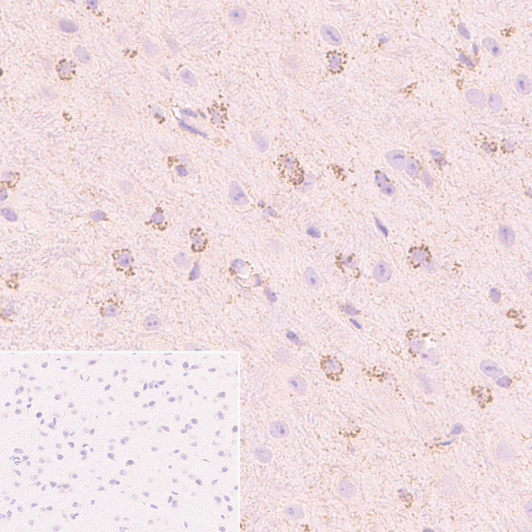 Immunohistochemistry (Formalin/PFA-fixed paraffin-embedded sections) - Anti-Smac/Diablo antibody [Y12] (AB32023)