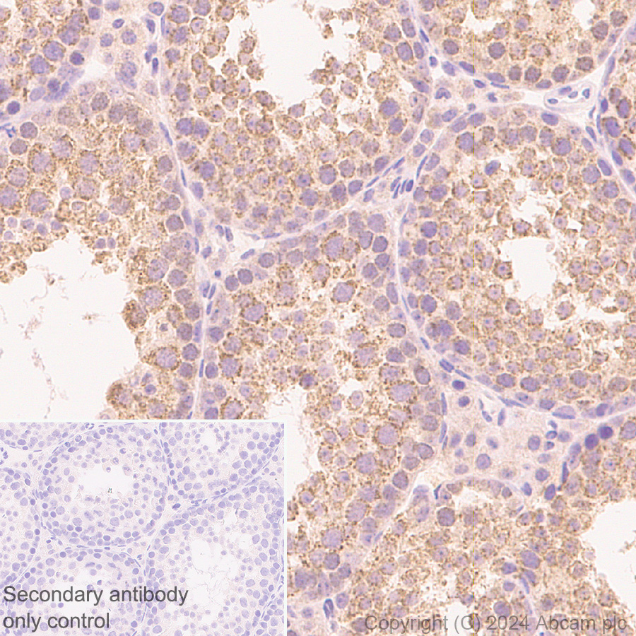 Immunohistochemistry (Formalin/PFA-fixed paraffin-embedded sections) - Anti-Smac/Diablo antibody [Y12] (ab32023), expandable thumbnail