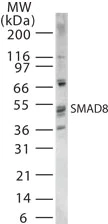 Western blot - Anti-SMAD 1/5/8/9 antibody (AB13723)