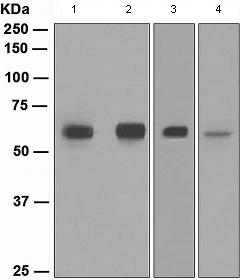 Western blot - Anti-SMAD 1 + SMAD9 antibody [EPR2290(2)] (AB108965)