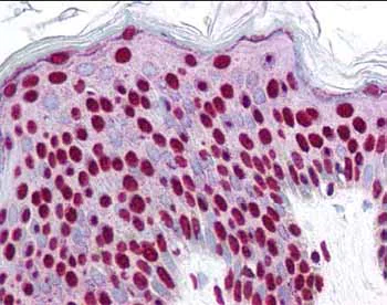 Immunohistochemistry (Formalin/PFA-fixed paraffin-embedded sections) - Anti-SMAD1/3/5 (phospho S423 + S425) antibody (AB51451)