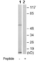 Western blot - Anti-SMAD1/5/9 antibody (AB80255)