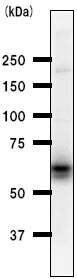 Western blot - Anti-Smad1 antibody [913C1b] (AB53745)
