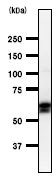 Western blot - Anti-Smad1 antibody [913C1b] (AB53745)