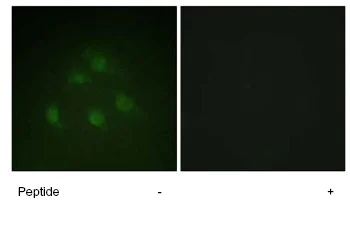 Immunocytochemistry/ Immunofluorescence - Anti-Smad1 antibody (AB63356)