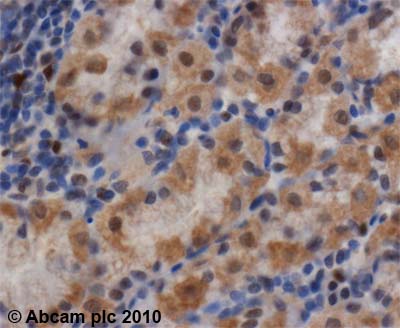 Immunohistochemistry (Formalin/PFA-fixed paraffin-embedded sections) - Anti-Smad1 antibody (AB63356)