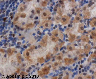 Immunohistochemistry (Formalin/PFA-fixed paraffin-embedded sections) - Anti-Smad1 antibody (AB63356)