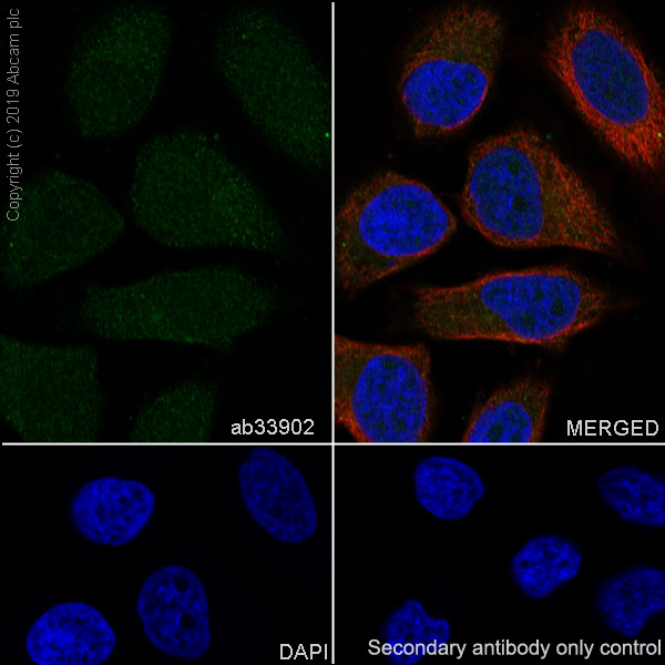 Immunocytochemistry/ Immunofluorescence - Anti-Smad1 antibody [EP565Y] - BSA and Azide free (AB172642)