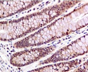 Immunohistochemistry (Formalin/PFA-fixed paraffin-embedded sections) - Anti-Smad1 antibody [EPR5522] (AB126761)