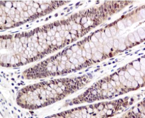 Immunohistochemistry (Formalin/PFA-fixed paraffin-embedded sections) - Anti-Smad1 antibody [EPR5522] (AB126761)