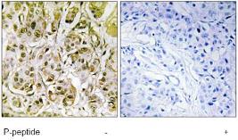 Immunohistochemistry (Formalin/PFA-fixed paraffin-embedded sections) - Anti-Smad1 (phospho S187) antibody (AB73211)