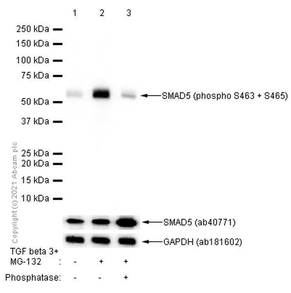Western blot - Anti-SMAD1 + SMAD5 + SMAD9 (phospho S463 + S465 + S467) antibody [EP728(2)AY] (AB76296)