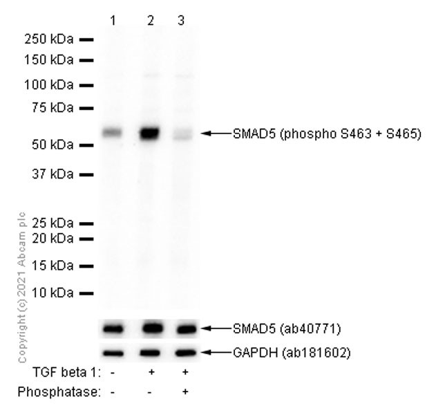 Western blot - Anti-SMAD1 + SMAD5 + SMAD9 (phospho S463 + S465 + S467) antibody [EP728(2)AY] (AB76296)