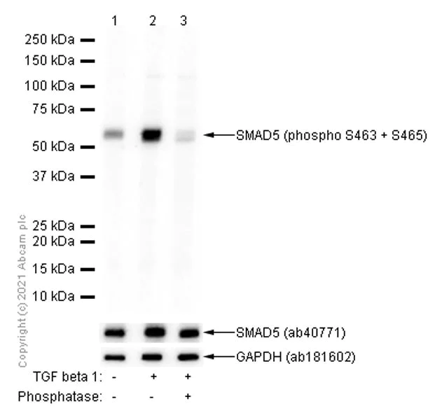 Western blot - Anti-SMAD1 + SMAD5 + SMAD9 (phospho S463 + S465 + S467) antibody [EP728(2)AY] (AB76296)