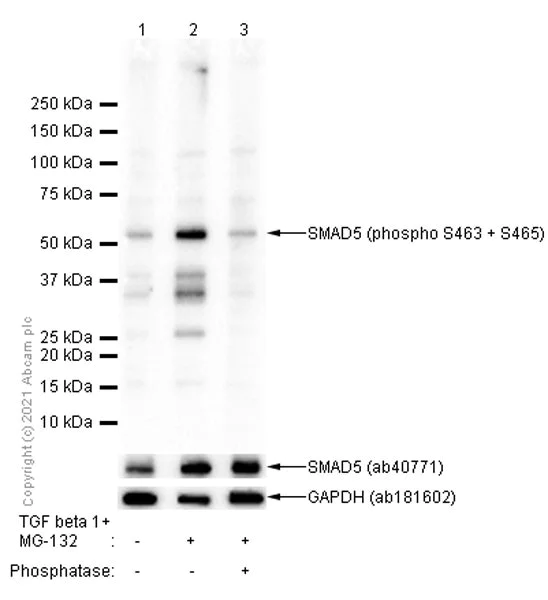 Western blot - Anti-SMAD1 + SMAD5 + SMAD9 (phospho S463 + S465 + S467) antibody [EP728(2)AY] (AB76296)