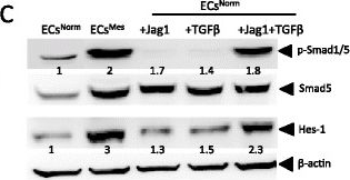 Western blot - Anti-SMAD1 + SMAD5 + SMAD9 (phospho S463 + S465 + S467) antibody [EP728(2)AY] (AB76296)