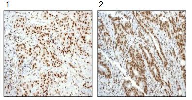 Immunohistochemistry (Formalin/PFA-fixed paraffin-embedded sections) - Anti-SMAD1 + SMAD5 + SMAD9 (phospho S463 + S465 + S467) antibody [MMC-1-104-3] (AB92698)
